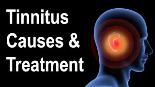 What is Tinnitus Causes amp Treatment Strategies [upl. by Hazem]