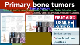 Primary bone tumors Benign tumors Osteochondroma Osteoma Osteoid osteoma Giant cell tumor etc [upl. by Llednahs]