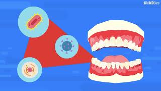 Understanding Tooth Abscesses Causes Treatment Prevention [upl. by Voltmer]