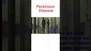 Gait impairment in Parkinson [upl. by Wilson308]