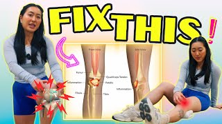 Fix Patellofemoral Pain FOREVER runners knee [upl. by Alehtse]