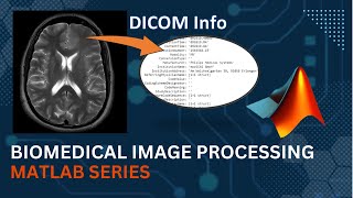 Getting Info of DICOM file  MATLAB  Medical Image Processing [upl. by Elwee]