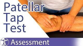 Patellar Tap Test  Ballottement Test⎟Knee Swelling [upl. by Eveiveneg]