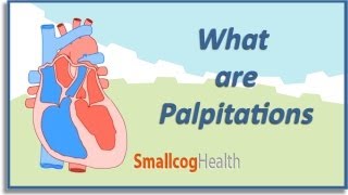 What are Palpitations [upl. by Ymmij]