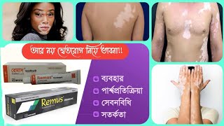 Remus Tacrolimus Ointment Review  এর উপকারীতা জানলে অবাক হবেন। শ্বেতরোগ [upl. by Swehttam]