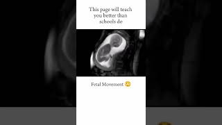 FETAL MOVEMENT😃 short youtubeshorts medical neet [upl. by Michaela56]