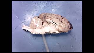 Sheep Brain Midsagittal View [upl. by Lobiv]