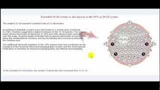 Understanding Anesthesia How It Affects Your Memory During Surgery [upl. by Aniretak689]