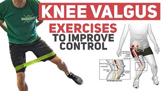 Knee Valgus  Rehab Exercises to Improve Movement Control [upl. by Airemaj]