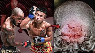 Broke His Opponents Bones The Scariest Muay Thai Fighter Ever  Rodtang Jitmuangnon [upl. by Biddie]