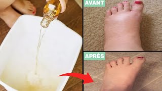 Voici Comment Soigner Vos Chevilles Et Pieds Enflés Naturellement [upl. by Winny204]