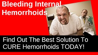 Bleeding Internal Hemorrhoids  How To Stop It [upl. by Brander516]