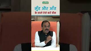 How to Cure Ulcerative colitis Naturally  Main Cause of Ulcerative Colitis  Acharya Manish ji [upl. by Beret]