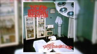 Dead Infection  Surgical Disembowelment 1993 FULL ALBUM [upl. by Ibed]