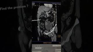 ct urography radiology ctscan [upl. by Sal310]