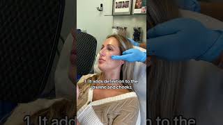 4 Benefits of Radiesse Filler  Dermfx Medspa [upl. by Mccutcheon426]