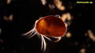 Ostracoda sp  Protozoans and other small critters [upl. by Yduj]