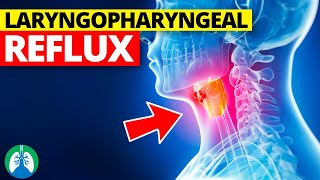 Laryngopharyngeal Reflux Medical Definition  Quick Explainer Video [upl. by Aicirpac774]