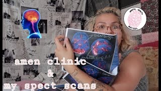 my amen clinic experience  brain spect scans [upl. by Roque]