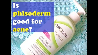 Is phisoderm good for acne [upl. by Mitman]