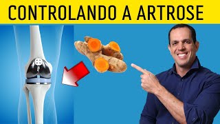 7 Dicas Para Quem Sofre com Artrose [upl. by Tigirb]