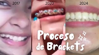 Mi proceso con BRACKETS 20202024 [upl. by Kayle]