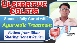 Ulcerative Colitis Ayurvedic Treatment Successfully Cured Patient From Bihar Sharing Honest Review [upl. by Milt386]