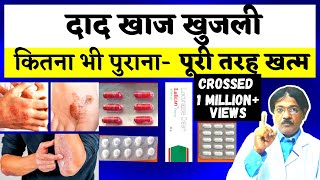 Dad Khaj Khujli Ki Dawa  दाद खाज खुजली को जड़ से ख़तम कैसे करे  3 Best Medicine For Dad Khaj Khujli [upl. by Weinrich]