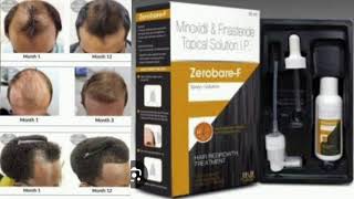 Zerobare F Topical Solution Minoxidil amp Finasteride Topical Solution [upl. by Hauhsoj815]