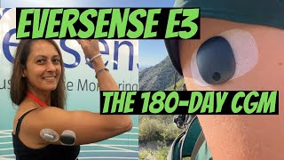 Eversense the 180day Continuous Glucose Monitor CGM [upl. by Nileuqaj]