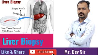 Liver biopsy nursing  Fundamental of nursing class by Dev Sir  Study Help And Health [upl. by Goldshell]