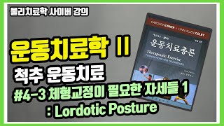 운동치료학 일반적인 잘못된 자세 유형 4가지 1전방경사 체형 Lordotic postureㅣ길이가 짧은 근육은 힘이 강한걸까 [upl. by Teece]