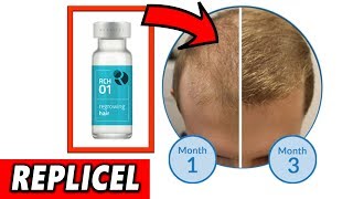 Replicel amp Shiseido Anti Hair Loss Treatment 2019 UPDATE [upl. by Zabrine]