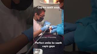 Ek hi din main badia hogayi smile  cosmeticdentist cosmeticsurgery dentalclinic bestdentist [upl. by Ailuig]