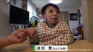 幼くして老化が進む難病コケイン症候群を抱える男の子 我が子の余命宣告を受けた両親 [upl. by Sucramraj]