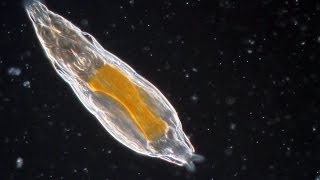 Bdelloid Rotifers so common yet so weird [upl. by Brozak]