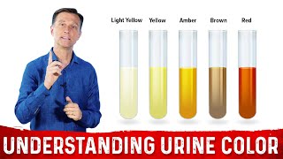 What Urine Color Indicates About Your Body – DrBerg [upl. by Tapes]