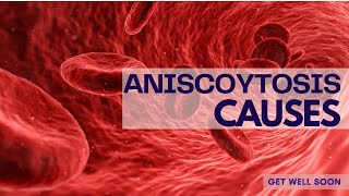 Anisocytosis Causes [upl. by Anilatac]