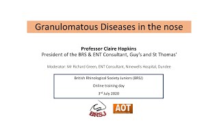 Rhinology  Granulomatous diseases in the nose  Prof Claire Hopkins [upl. by Nylarat]