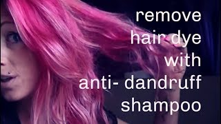 Remove Hair Dye with Anti Dandruff Shampoo no Bleach [upl. by Aisilef]