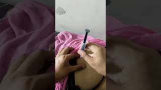 injection video ll injection viral video ll intramuscular injection procedure ll intramuscular llll [upl. by Aikim]