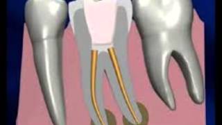 Relación de otras especialidades con la endodoncia [upl. by Ahsiekit63]