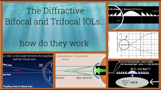 The Diffractive Bifocal and Multifocal IOLs  how do they work  The Science and the Physics [upl. by Nanek]