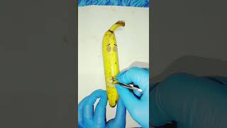 Ring in The Banana 🍌 Need Emergency Surgeryshorts trending [upl. by Rohclem174]