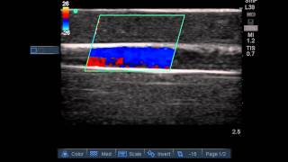 Peripheral Doppler Ultrasound Training Model [upl. by Neiman]