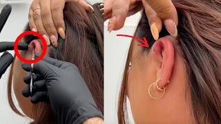 Jonys Vlog 013 We Saved an extremely swollen forward Helix Piercing [upl. by Medeah]