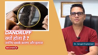 Why does dandruff occur Learn about its causes and treatment Dr Jangid  SkinQure [upl. by Rubina]