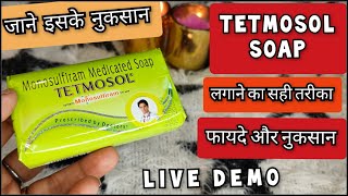 Tetmosol Soap  Tetmosol Soap Benefits  टेटमोसोल साबुन  फायदे और नुकसान  Shruti Mishra [upl. by Seek397]