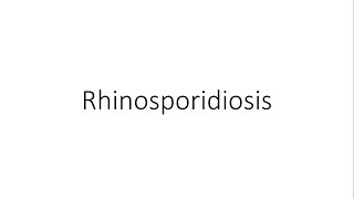 Rhinosporidiosis  ENT [upl. by Newlin]