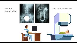 The CARE foundation  Ultrasound cystography [upl. by Mraz]